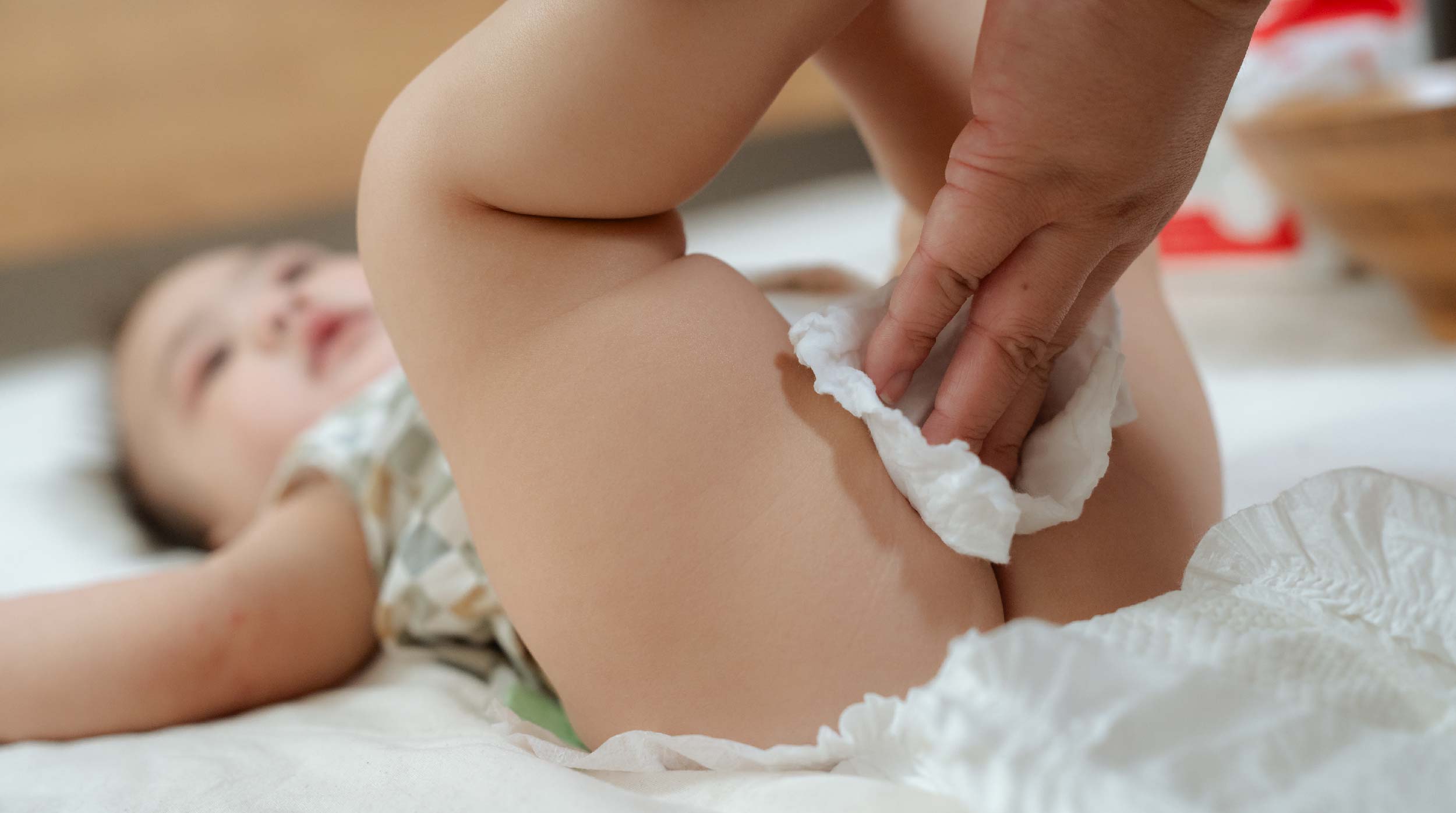 How to Prevent Diaper Rash in 5 Easy Steps